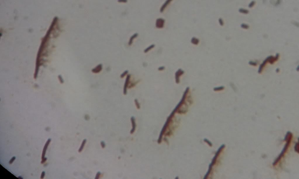 Flagella Stain